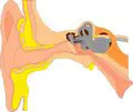 Ear-1